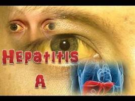 Gambar Hepatitis A