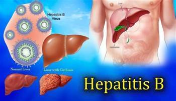 Gambar Hepatitis B