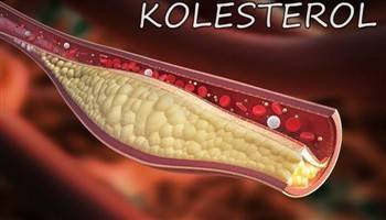 Gambar Kolesterol