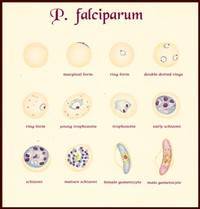 Gambar Malaria Falciparum