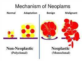Gambar Neoplasma