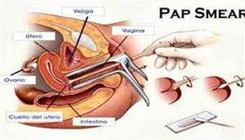 Gambar Pap Smear